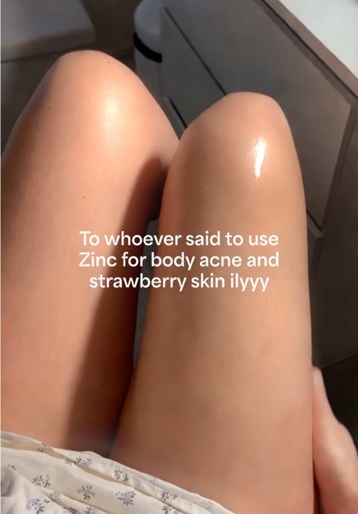 #acne